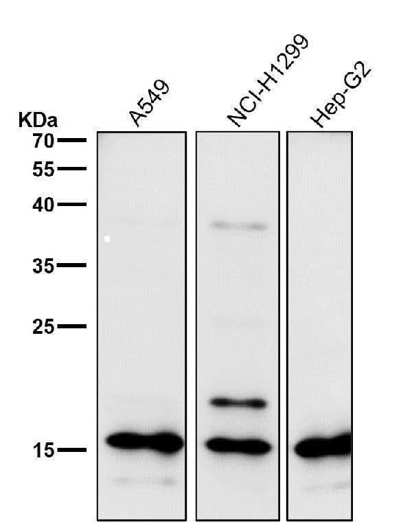 Anti-Uteroglobin SCGB1A1 Monoclonal Antibody Boster Bio