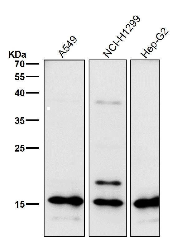 Anti-Uteroglobin SCGB1A1 Monoclonal Antibody Boster Bio