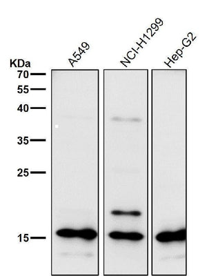 Anti-Uteroglobin SCGB1A1 Monoclonal Antibody Boster Bio