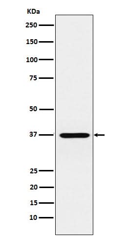 Anti-CRX Monoclonal Antibody Boster Bio