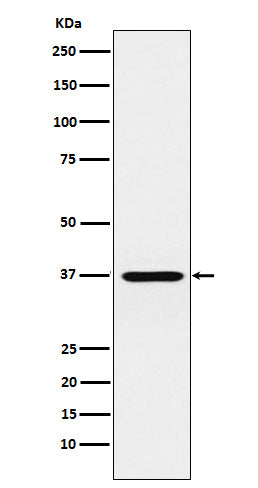 Anti-CRX Monoclonal Antibody Boster Bio
