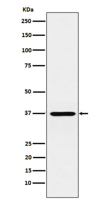 Anti-CRX Monoclonal Antibody Boster Bio