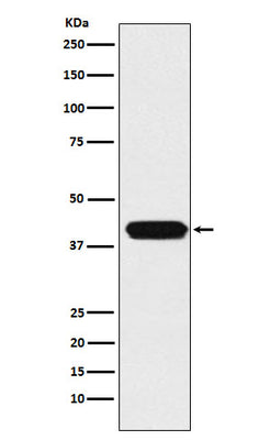 Anti-ATOH1 Rabbit Monoclonal Antibody Boster Bio