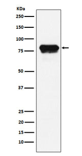 Anti-PLTP Rabbit Monoclonal Antibody Boster Bio