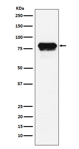Anti-PLTP Rabbit Monoclonal Antibody Boster Bio
