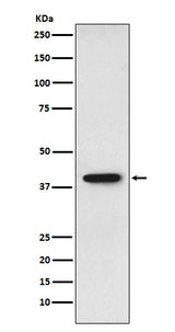 Anti-SET Monoclonal Antibody Boster Bio