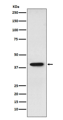 Anti-SET Monoclonal Antibody Boster Bio