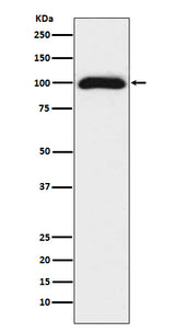Anti-CD276/B7 H3 Rabbit Monoclonal Antibody Boster Bio
