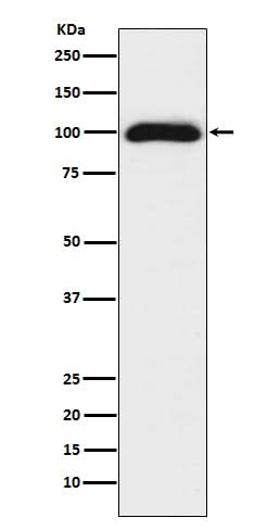 Anti-CD276/B7 H3 Rabbit Monoclonal Antibody Boster Bio