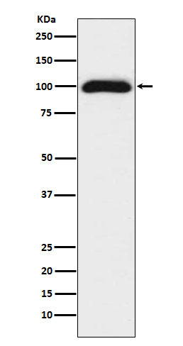 Anti-CD276/B7 H3 Rabbit Monoclonal Antibody Boster Bio