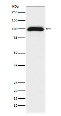 Anti-CD276/B7 H3 Rabbit Monoclonal Antibody Boster Bio