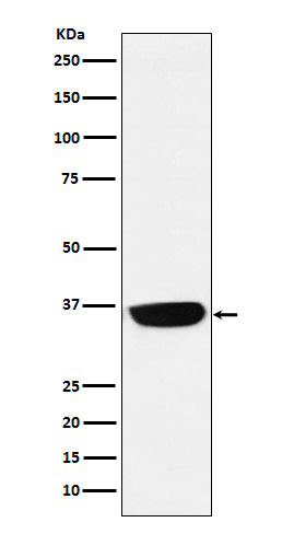 Anti-PHOX2B Monoclonal Antibody Boster Bio