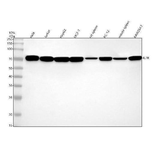 Anti-IL7R alpha/CD127 Rabbit Monoclonal Antibody Boster Bio