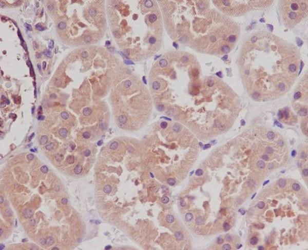 Anti-STK3/Mst2 Rabbit Monoclonal Antibody Boster Bio