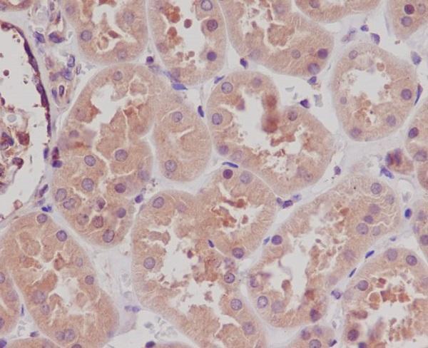 Anti-STK3/Mst2 Rabbit Monoclonal Antibody Boster Bio