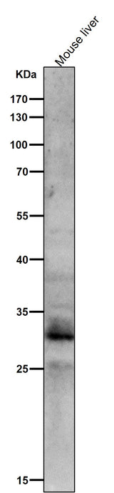 Anti-Phospho-MST1/MST2 (T183 + T180) Rabbit Monoclonal Antibody Boster Bio