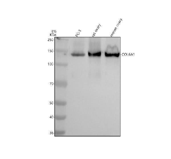 Anti-Collagen VI COL6A1 Rabbit Monoclonal Antibody Boster Bio