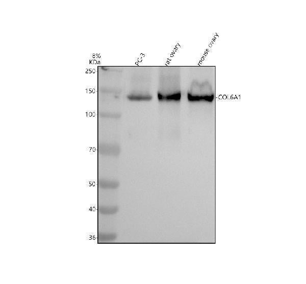 Anti-Collagen VI COL6A1 Rabbit Monoclonal Antibody Boster Bio