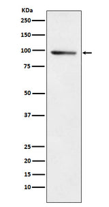 Anti-PDE4B Rabbit Monoclonal Antibody Boster Bio