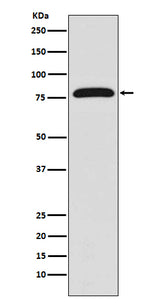Anti-TGM2/Transglutaminase 2 Rabbit Monoclonal Antibody Boster Bio