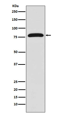 Anti-TGM2/Transglutaminase 2 Rabbit Monoclonal Antibody Boster Bio