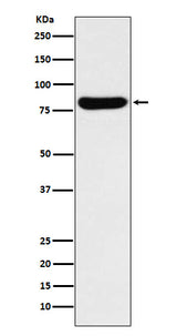 Anti-GUSB Rabbit Monoclonal Antibody Boster Bio