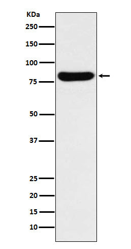 Anti-GUSB Rabbit Monoclonal Antibody Boster Bio