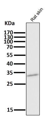 Anti-CD8 CD8A Rabbit Monoclonal Antibody Boster Bio