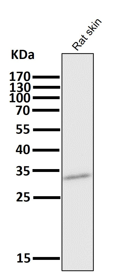 Anti-CD8 CD8A Rabbit Monoclonal Antibody Boster Bio