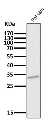 Anti-CD8 CD8A Rabbit Monoclonal Antibody Boster Bio