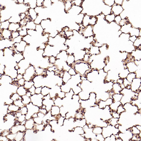Anti-CD8 alpha Rabbit Monoclonal Antibody Boster Bio