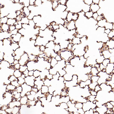 Anti-CD8 alpha Rabbit Monoclonal Antibody Boster Bio