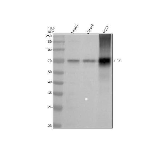 Anti-Hemopexin HPX Monoclonal Antibody Boster Bio