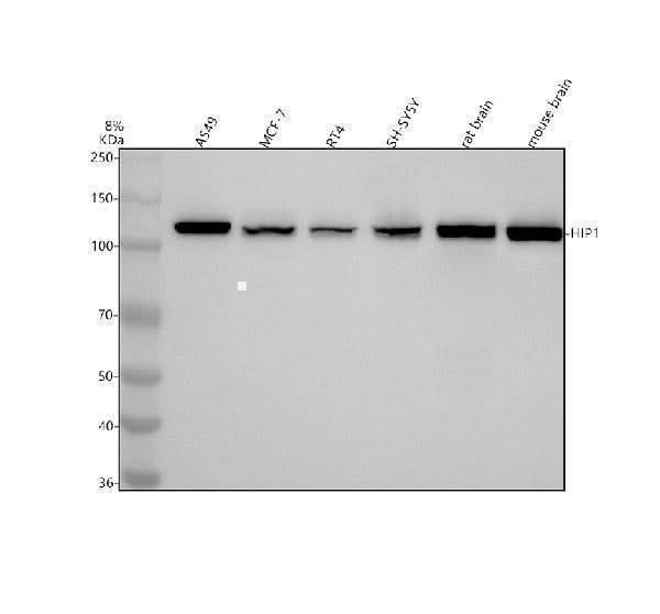 Anti-HIP1 Monoclonal Antibody Boster Bio