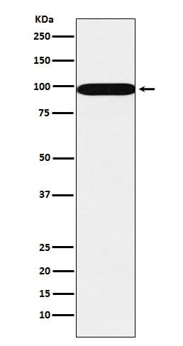 Anti-SFPQ Monoclonal Antibody Boster Bio