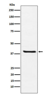 Anti-Arg2 Rabbit Monoclonal Antibody Boster Bio