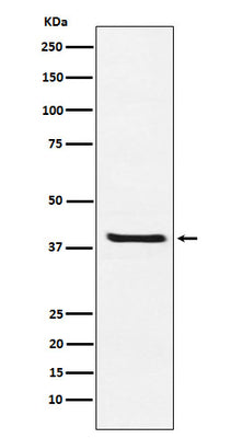 Anti-Arg2 Rabbit Monoclonal Antibody Boster Bio