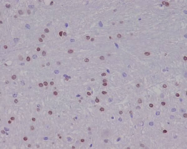 Anti-Olig2 Rabbit Monoclonal Antibody Boster Bio