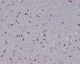 Anti-Olig2 Rabbit Monoclonal Antibody Boster Bio