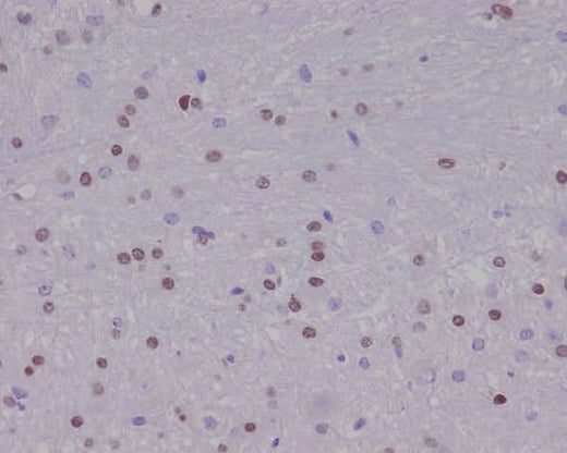 Anti-Olig2 Rabbit Monoclonal Antibody Boster Bio