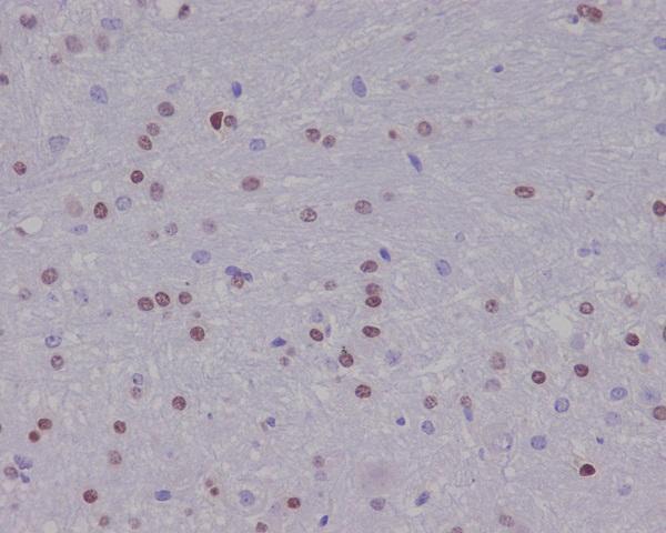 Anti-Olig2 Rabbit Monoclonal Antibody Boster Bio