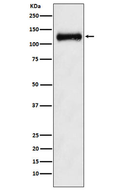 Anti-ANPRB Rabbit Monoclonal Antibody Boster Bio