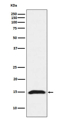 Anti-Fragilis IFITM3 Monoclonal Antibody Boster Bio