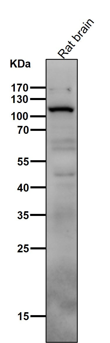 Anti-PI 3 Kinase p110 delta PIK3CD Rabbit Monoclonal Antibody Boster Bio