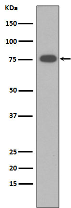 Anti-Vitronectin VTN Rabbit Monoclonal Antibody Boster Bio