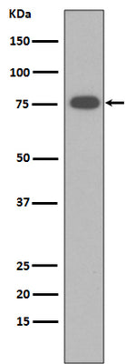 Anti-Vitronectin VTN Rabbit Monoclonal Antibody Boster Bio