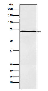 Anti-LOX12 Rabbit Monoclonal Antibody Boster Bio