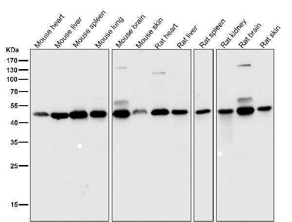 Anti-DUSP1/Mkp 1 Rabbit Monoclonal Antibody Boster Bio