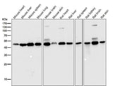 Anti-DUSP1/Mkp 1 Rabbit Monoclonal Antibody Boster Bio