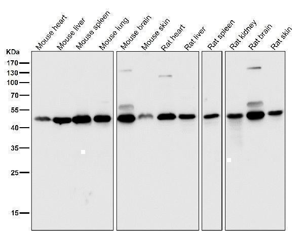 Anti-DUSP1/Mkp 1 Rabbit Monoclonal Antibody Boster Bio